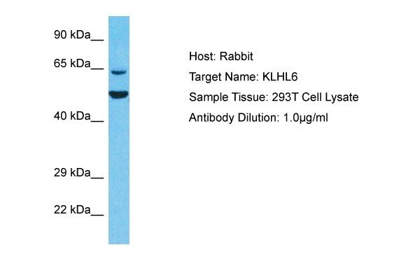 KLHL6 Antibody in Western Blot (WB)