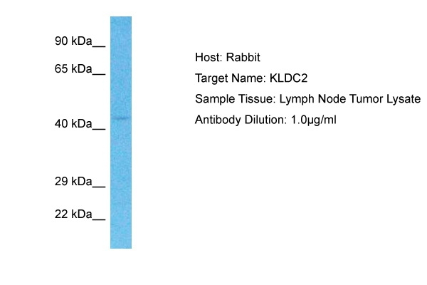 KLHDC2 Antibody in Western Blot (WB)