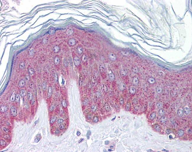IL-33 Antibody in Immunohistochemistry (IHC)