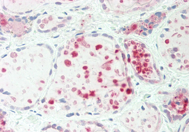 IARS Antibody in Immunohistochemistry (Paraffin) (IHC (P))
