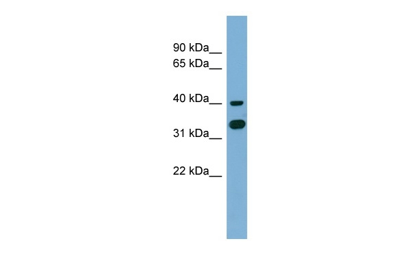 GPN2 Antibody in Western Blot (WB)