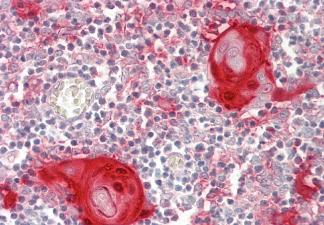 Galectin 7 Antibody in Immunohistochemistry (Paraffin) (IHC (P))
