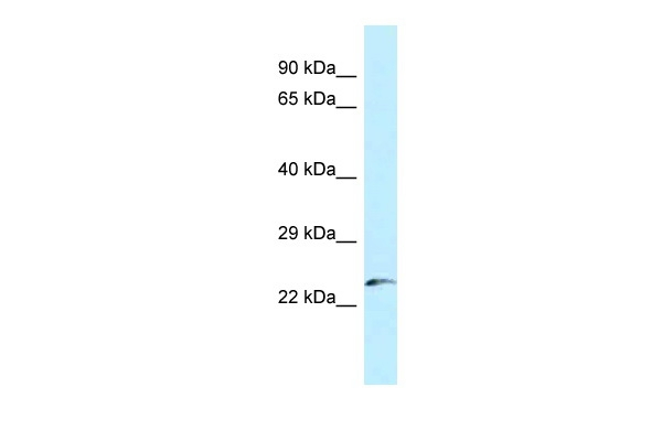 FLJ43806 Antibody in Western Blot (WB)