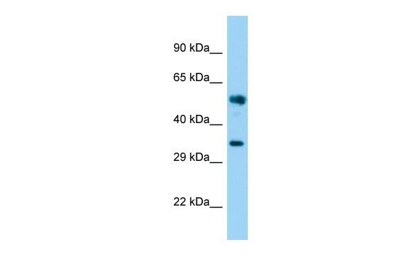 FAM49B Antibody in Western Blot (WB)