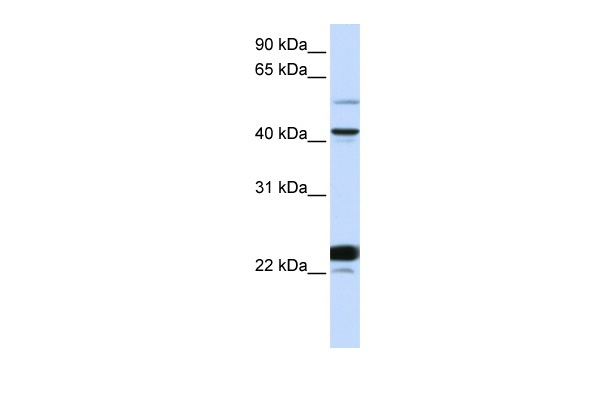 EVX1 Antibody in Western Blot (WB)