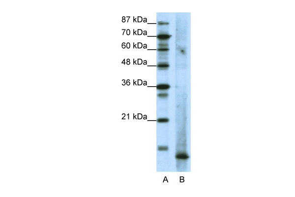 MECOM Antibody in Western Blot (WB)