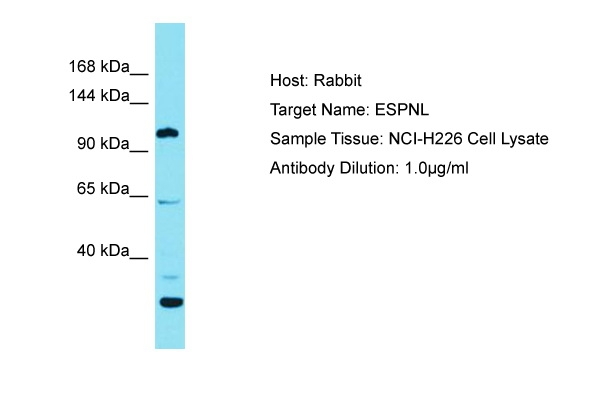 ESPNL Antibody in Western Blot (WB)