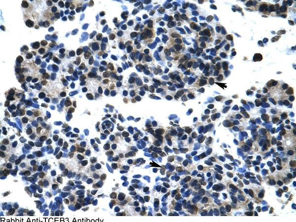 ELOA Antibody in Immunohistochemistry (IHC)