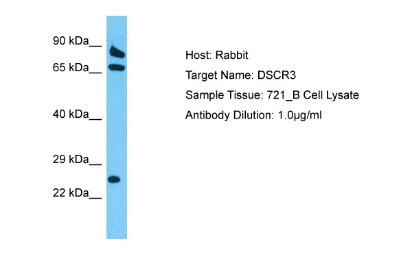 DSCR3 Antibody in Western Blot (WB)