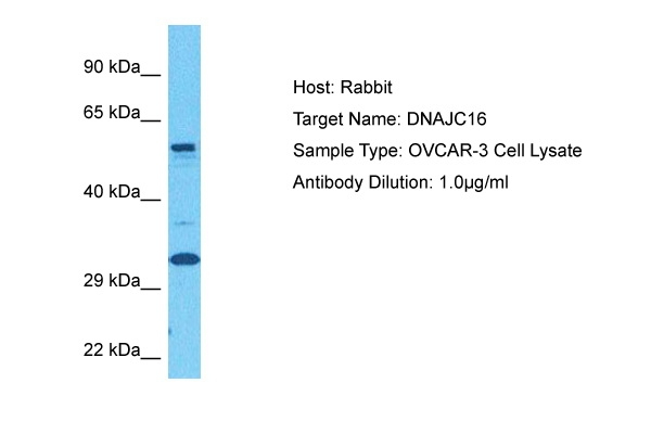 DNAJC16 Antibody in Western Blot (WB)