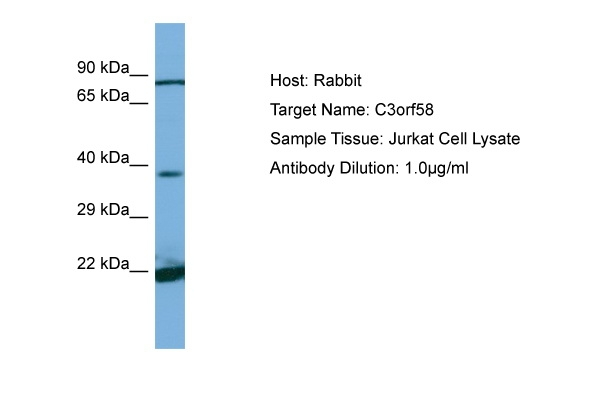 DIPK2A Antibody in Western Blot (WB)