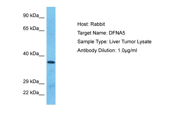 DFNA5 Antibody in Western Blot (WB)