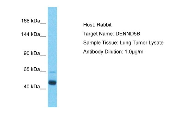 DENND5B Antibody in Western Blot (WB)