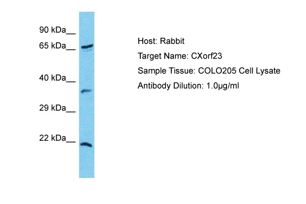 CXorf23 Antibody in Western Blot (WB)