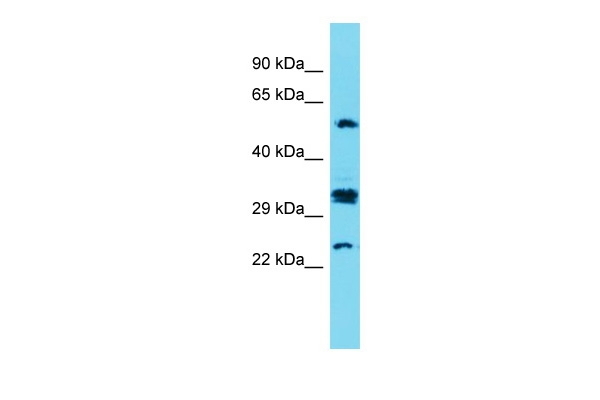 CT47A7 Antibody in Western Blot (WB)