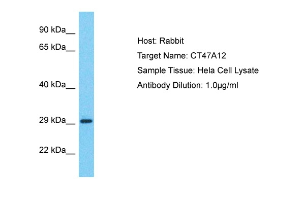 CT47A12 Antibody in Western Blot (WB)