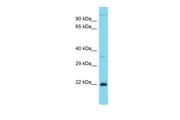 CT45A Antibody in Western Blot (WB)