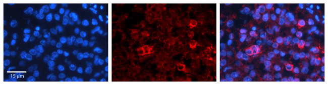 COX1 Antibody in Immunohistochemistry (Paraffin) (IHC (P))