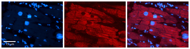 CITED2 Antibody in Immunohistochemistry (Paraffin) (IHC (P))