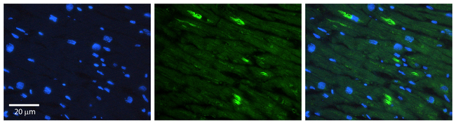 CD97 Antibody in Immunohistochemistry (Paraffin) (IHC (P))