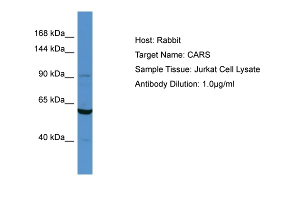 CARS Antibody in Western Blot (WB)