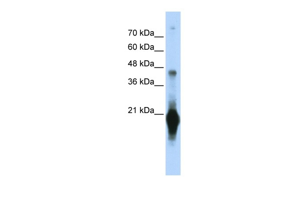 C17orf49 Antibody in Western Blot (WB)