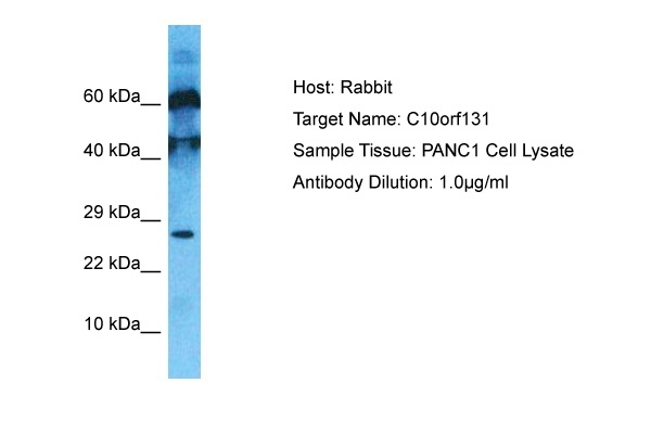 C10orf131 Antibody in Western Blot (WB)