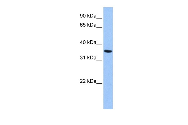 ANXA8L2 Antibody in Western Blot (WB)