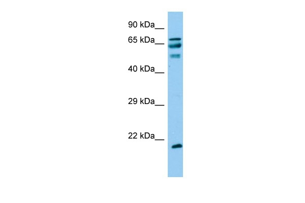 ANKRD60 Antibody in Western Blot (WB)