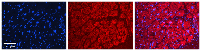 alanyl-tRNA Synthetase Antibody in Immunohistochemistry (Paraffin) (IHC (P))