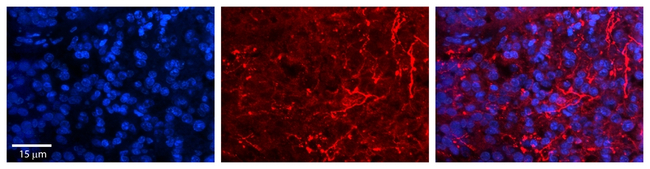 alanyl-tRNA Synthetase Antibody in Immunohistochemistry (Paraffin) (IHC (P))