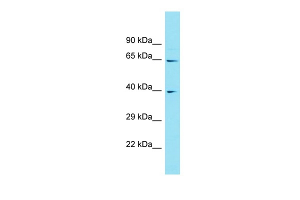 ABHD17C Antibody in Western Blot (WB)