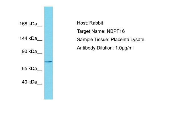 NBPF15 Antibody in Western Blot (WB)