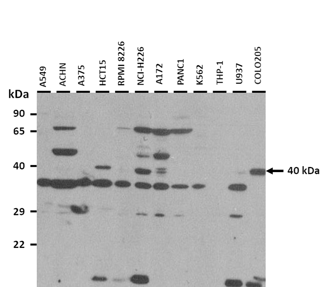Histone Macro-H2A.1 Antibody in Western Blot (WB)