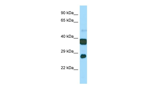 ATP Synthase gamma Antibody in Western Blot (WB)