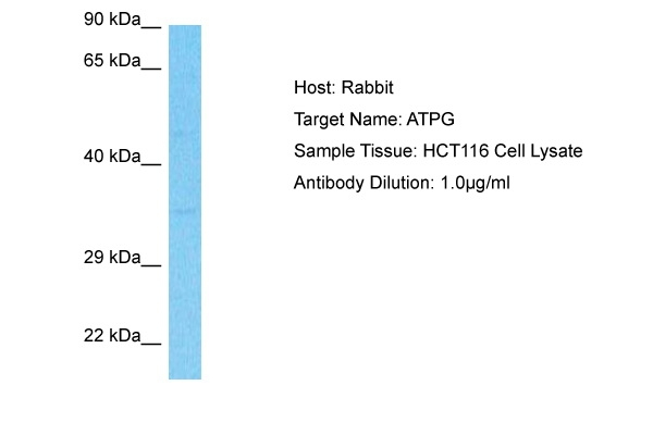 ATP Synthase gamma Antibody in Western Blot (WB)