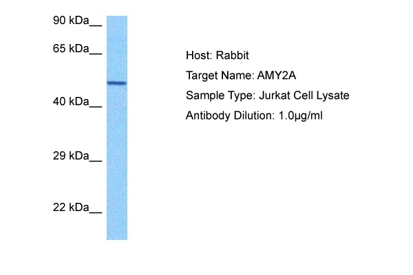 alpha Amylase Antibody in Western Blot (WB)
