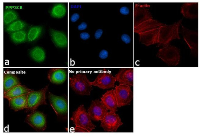 PPP3CB Antibody in Immunocytochemistry (ICC/IF)