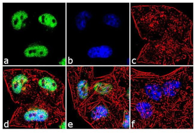Cyclin C Antibody in Immunocytochemistry (ICC/IF)