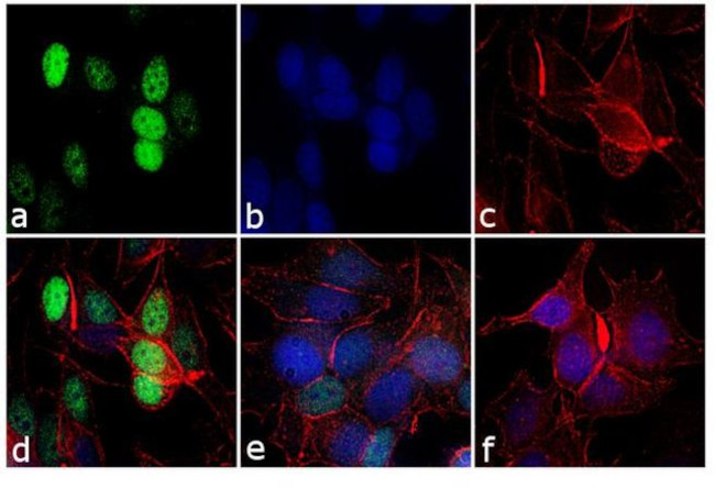 Cyclin D1 Antibody in Immunocytochemistry (ICC/IF)