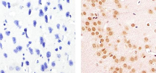 Cyclin E Antibody in Immunohistochemistry (Paraffin) (IHC (P))