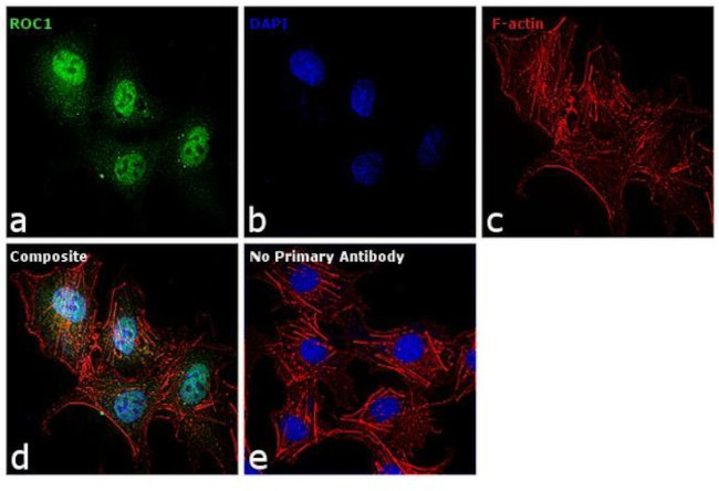 ROC1 Antibody in Immunocytochemistry (ICC/IF)
