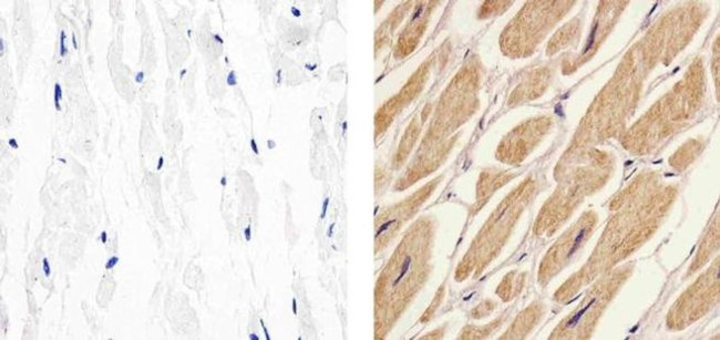 Caspase 9 Antibody in Immunohistochemistry (Paraffin) (IHC (P))