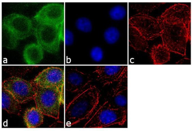 Androgen Receptor Antibody in Immunocytochemistry (ICC/IF)