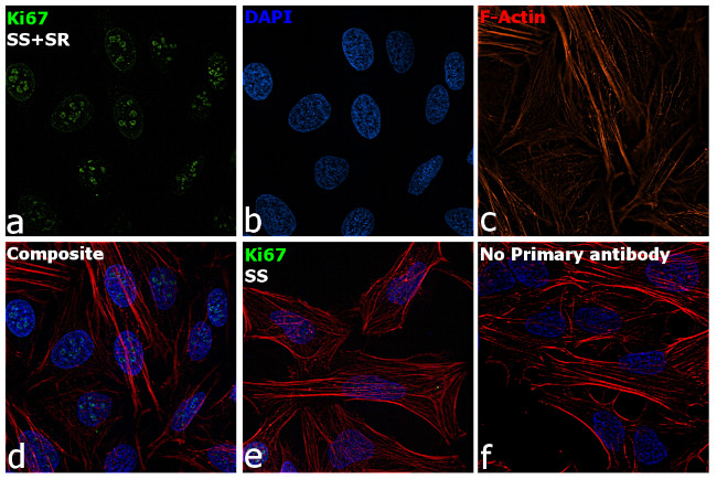 Ki-67 Antibody in Immunocytochemistry (ICC/IF)