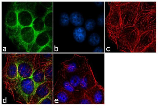 MMP1 Antibody in Immunocytochemistry (ICC/IF)