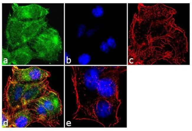 MMP9 Antibody in Immunocytochemistry (ICC/IF)