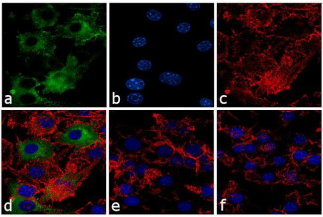 iNOS Antibody in Immunocytochemistry (ICC/IF)