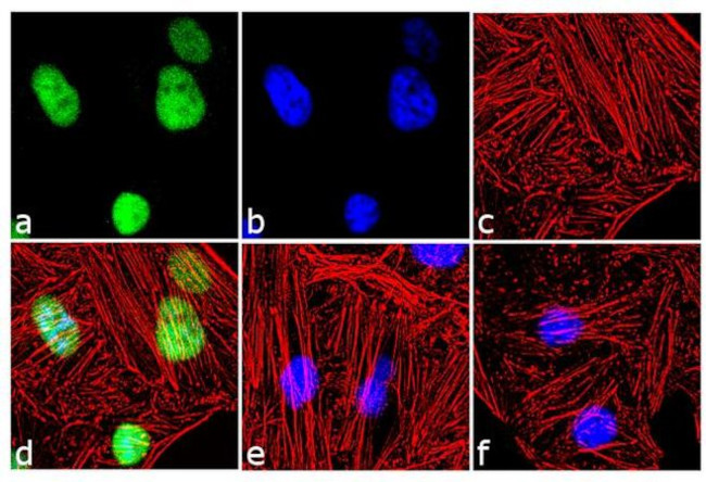 PARP1 Antibody in Immunocytochemistry (ICC/IF)