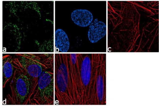 GCLC Antibody in Immunocytochemistry (ICC/IF)